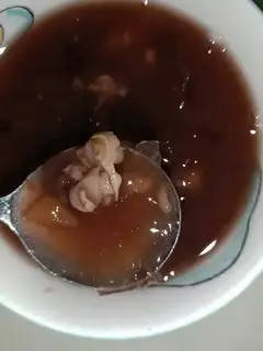 The pulmonary soup