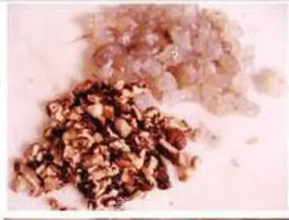 Make step 6