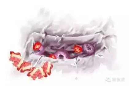 Make Black pepper tin paper roasted ribs step 2