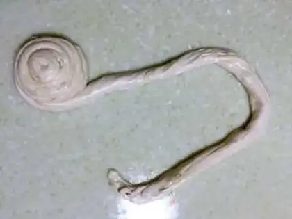 Make Pretzel onions step 9