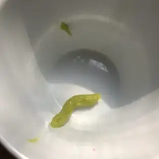 Make Potato mashed pickles step 10