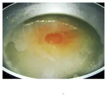 Make step 10